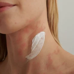 EXTRODERM Intensivcreme